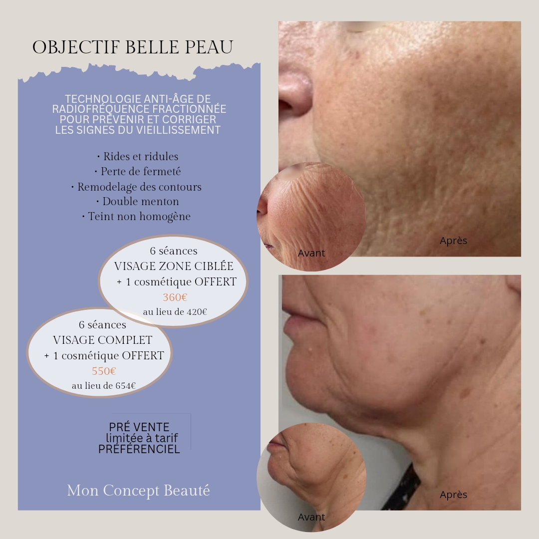 Objectif Belle peau - offre Mon Concept Beauté