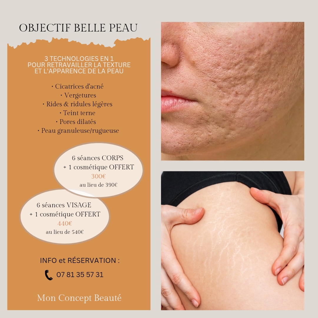 Objectif Belle peau - offre automne