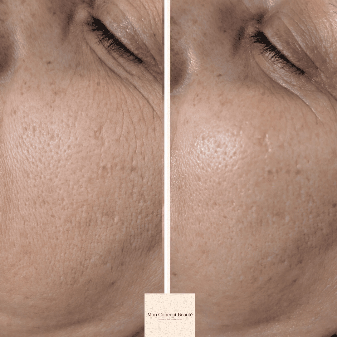 Soin de la peau mon concept beauté